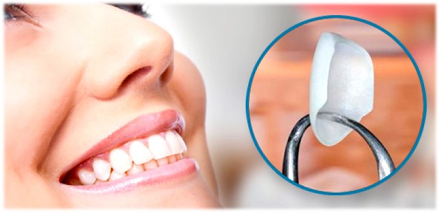 Curso natural smile para doctores y auxiliares